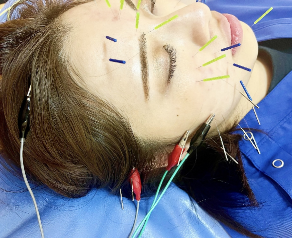 体験者の声